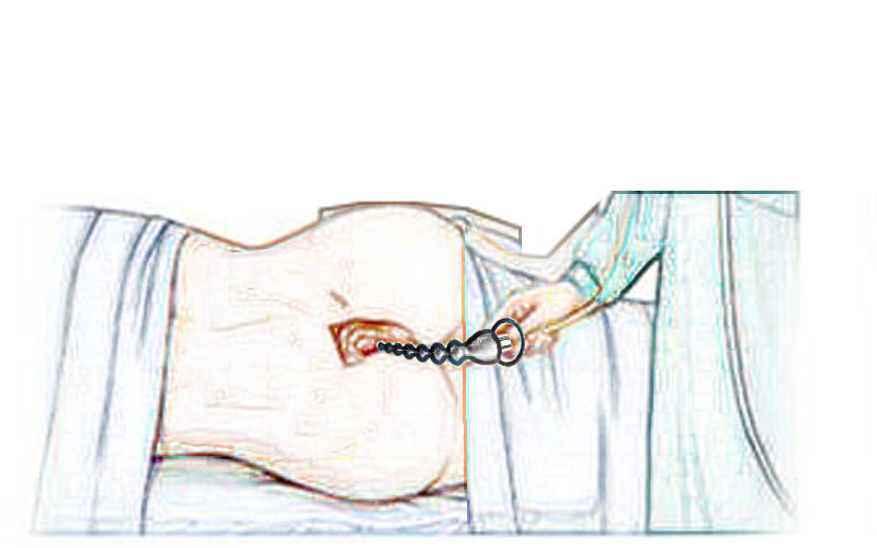 Kho sỉ Máy rung kích hậu môn Black Mont  nhập khẩu